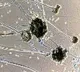 Black fungus spreading very fase in India
