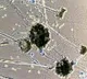Black fungus patient died in Gandhi hospital