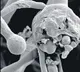 More Men Infected with Black Fungus Than Women
