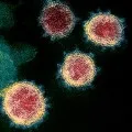 New coronavirus detected in patients in Malaysia it has come from dogs