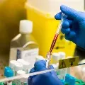Antibodies were present in 79 percent of people who took 2 doses of corona vaccine in AP