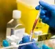 Antibodies were present in 79 percent of people who took 2 doses of corona vaccine in AP