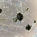 11717 Cases Of Black Fungus So Far In India
