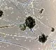11717 Cases Of Black Fungus So Far In India