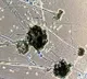 Black Fungus spreading in Andhra Pradesh