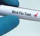 bird flue in human