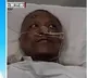 Wuhan doctor whose skin turned dark due to COVID treatment returning to normal