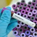 BJP senior leader tested corona positive in Telangana