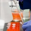 new 397 COVID19 infections in telangana