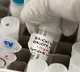 People Hesitate covid Vaccination in Slow Pace