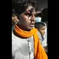 Police pushed lock into youth forehead