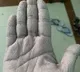 UP Doctor Hand Pic Goes Viral
