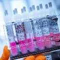 Oxford vaccine covishield may come on October