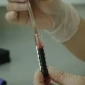 FDA Green Signals to Plasma Therapy