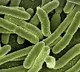 More than 6000 people test positive for brucellosis in China
