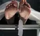 Private hospital in secunderabad charged 12 lakh for two weeks treatment