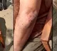 miscreant attack on pattabhi