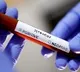Above3000Corona Positive Cases Missing in Bengalore