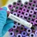 Seventy more corona positive cases in AP