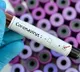 150 Corona patients missing in Prakasam Dist