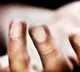 Girl Attacked On Crowded Street In Visakhapatnam