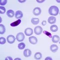 New type of Malaria emerges in Kerala