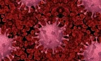 Five-fold increase in cases of advanced cataract and dry eyes during the pandemic