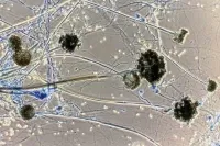 MSN Labs launches Posaconazole (PosaOne) to treat black fungus