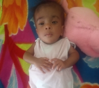 SLG Doctors save life of six-months baby girl born with a “head-sized” swelling near the brain