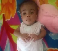 SLG Doctors save life of six-months baby girl born with a “head-sized” swelling near the brain