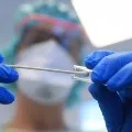 ICMR Guidelines on Rapid Antibody Tests