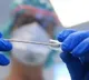 ICMR Guidelines on Rapid Antibody Tests