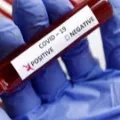 Mangalagiri man tested positive high alert in town