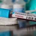 important decision taken by AP government on Corona