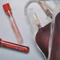 Man on ventilator given plasma therapy in Delhi Doctors say responding