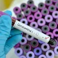Youth highly infected by corona in AP than other age groups