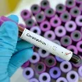 Ayushman Bharat office in Delhi closed after employ tested corona positive