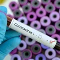 Telangana constable tests corona positive