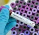 ICMR said eight thousand samples being tested across the country