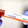 India crosses 20 thousand corona cases