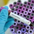 Telangana corona positive cases total hiked