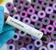 Three year Boy infected to Corona virus in Telangana