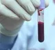 People With Blood Type A More Vulnerable To Coronavirus