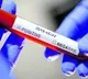 Seven year old Boy in Sangareddy infected to Coronavirus