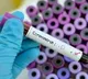 Corona positive cases toll reaches four hundred and two in ap