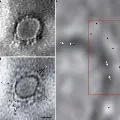 Indian scientists have revealed a microscopy image of SARS CoV 2 virus