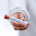 1001 Corona virus positive cases in Telangana