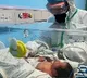 Corona causes swelling in children