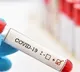 woman home guard infected to coronavirus in visakha