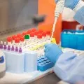 how much does coronavirus test cost in india